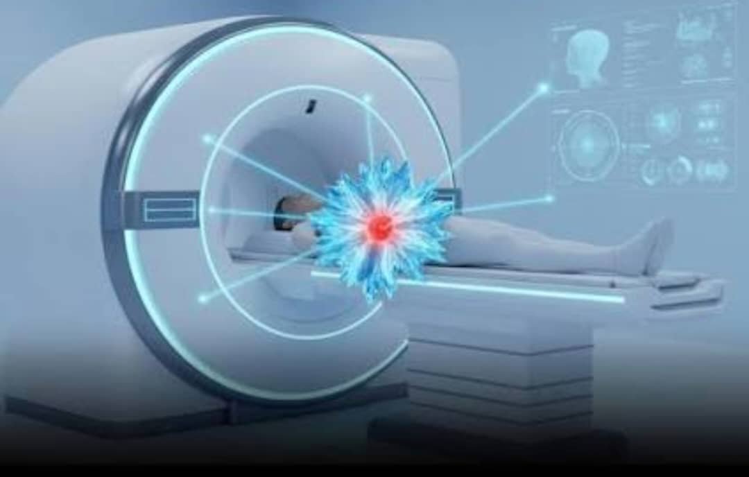 Cryoablation Therapy