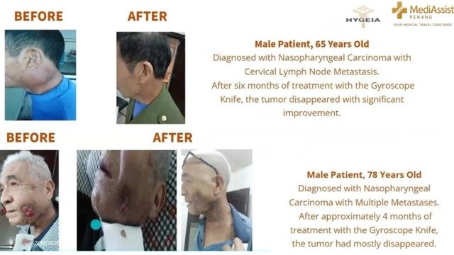 Patient testimonial 1